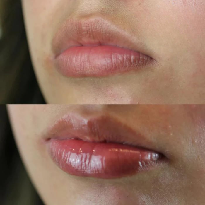 Lip Plumper Serum