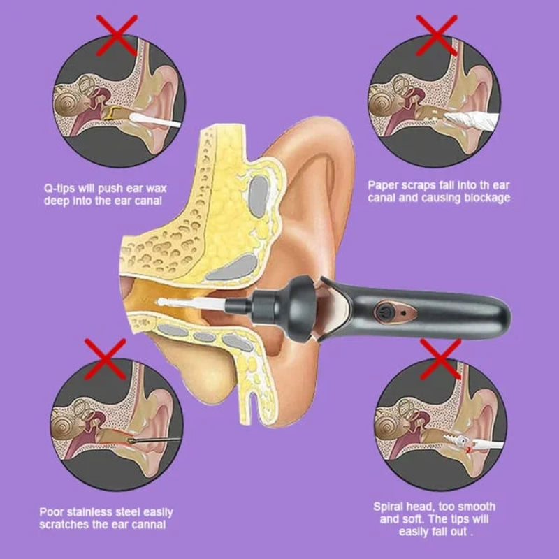 Painless ear cleaning device