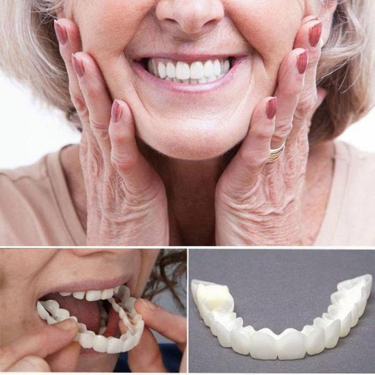 Perfect Smile Snap-On Braces